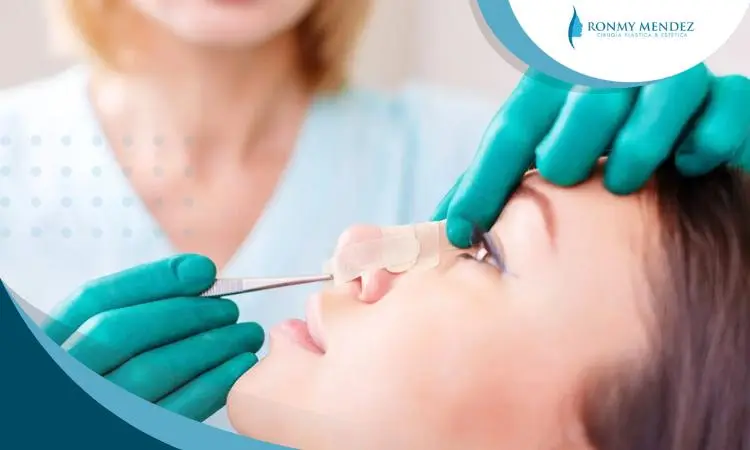 posoperatorio-rinoplastia-consejos