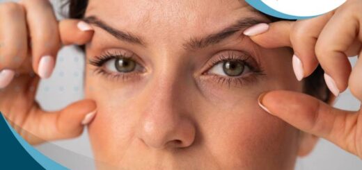 blefaroplastia-solucion-caida-parpados