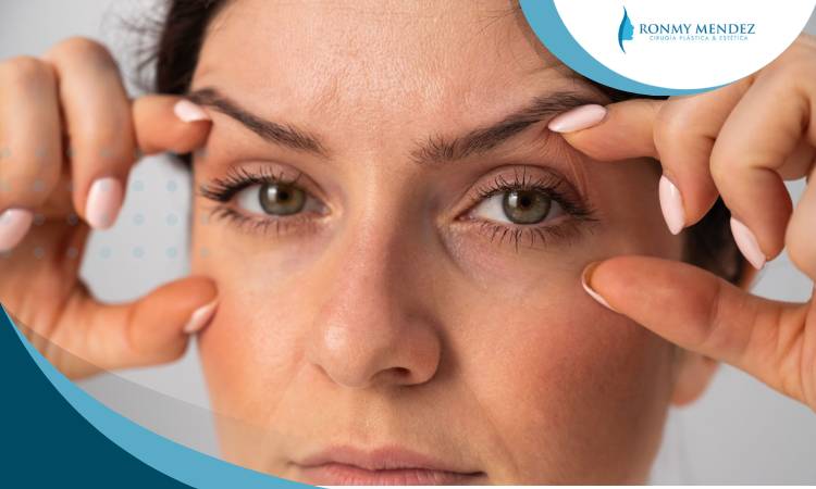 blefaroplastia-solucion-caida-parpados